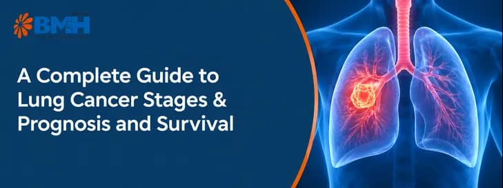 Lung Cancer Stages & Prognosis 1