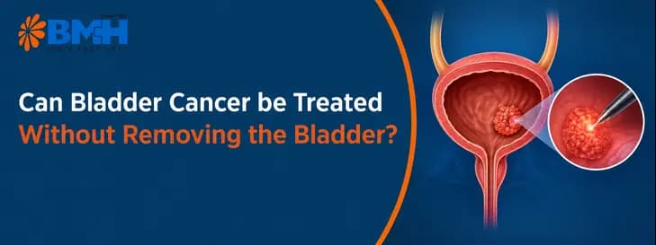 Can Bladder Cancer be Treated Without Removing the Bladder? 1
