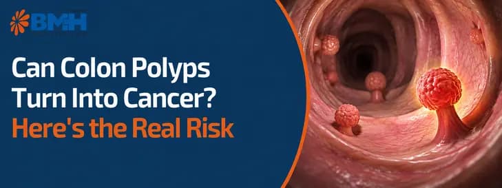 Can Colon Polyps Turn Into Cancer?